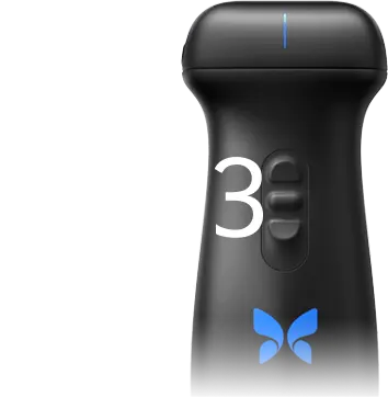 Butterfly IQ3 v2 – Butterfly Brasil